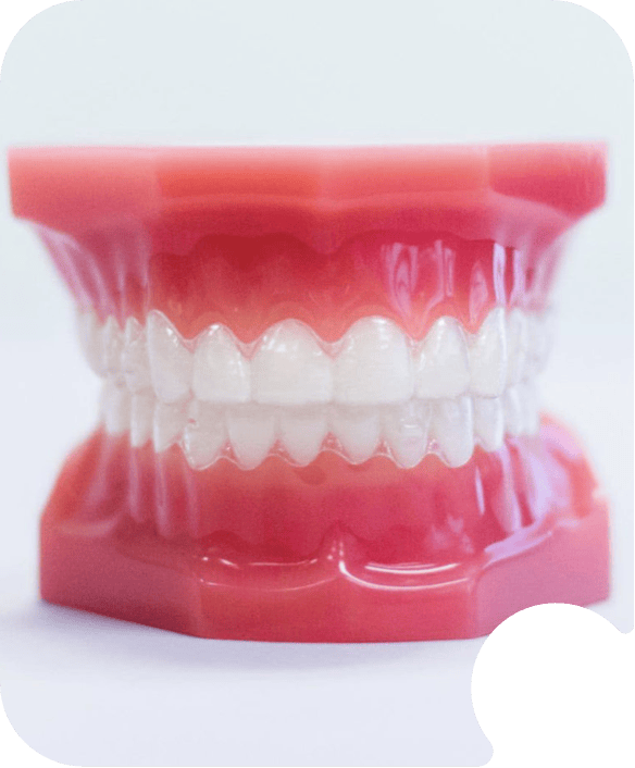 clear aligners