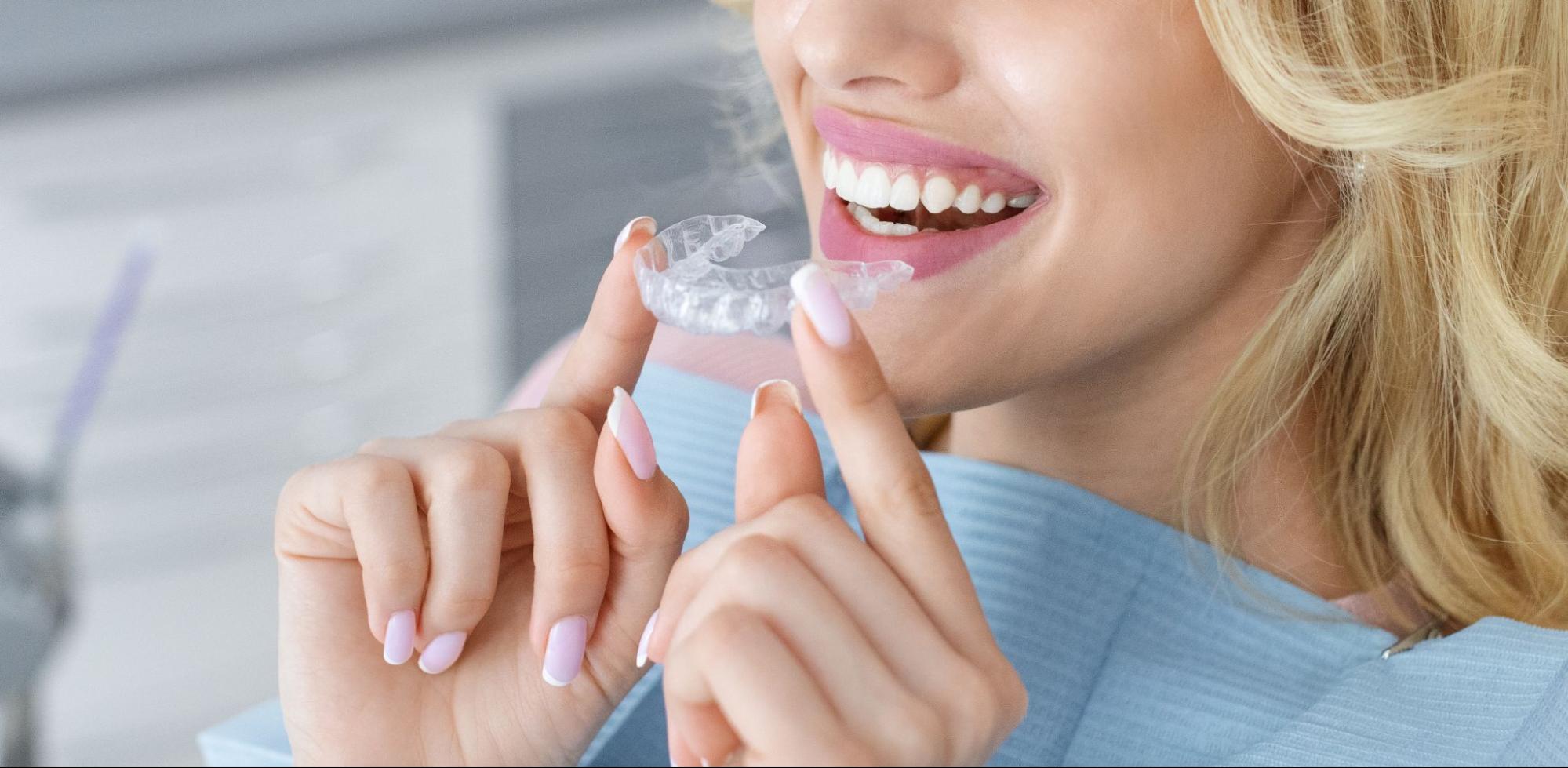 What Are The Benefits of In-House Custom Aligners?